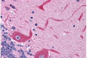 Immunohistochemistry (Paraffin-embedded Sections) (IHC (p)) image for anti-Glutamate Receptor, Ionotropic, N-Methyl D-Aspartate 2c (GRIN2C) (AA 69-118) antibody (ABIN6736392)