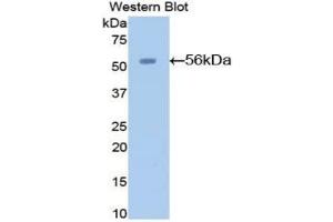 Western Blotting (WB) image for anti-Angiotensinogen (serpin Peptidase Inhibitor, Clade A, Member 8) (AGT) (AA 23-477) antibody (ABIN7432628)