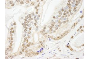 Immunohistochemistry (IHC) image for anti-PDS5, Regulator of Cohesion Maintenance, Homolog B (PDS5B) (AA 1200-1250) antibody (ABIN7448998)