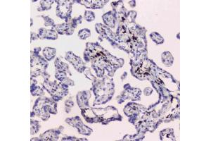 IHC testing of FFPE human placental tissue with DC-SIGN antibody at 1ug/ml. (DC-SIGN/CD209 抗体)