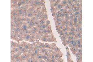 IHC-P analysis of Mouse Tissue, with DAB staining. (Vitamin D-Binding Protein 抗体  (AA 395-473))