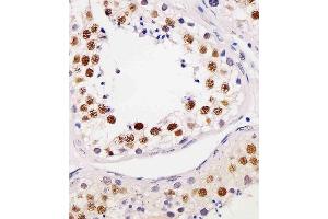 Immunohistochemistry (Paraffin-embedded Sections) (IHC (p)) image for anti-Telomeric Repeat Binding Factor 2, Interacting Protein (TERF2IP) (AA 1-399) antibody (ABIN6244015)