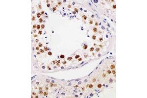(ABIN6244015 and ABIN6577179) staining TE2IP in human testis tissue sections by Immunohistochemistry (IHC-P - paraformaldehyde-fixed, paraffin-embedded sections). (RAP1 抗体  (AA 1-399))