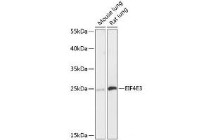 Western blot analysis of extracts of various cell lines using EIF4E3 Polyclonal Antibody at dilution of 1:3000. (EIF4E3 抗体)