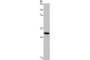 Gel: 10 % SDS-PAGE, Lysate: 40 μg, Lane: Human fetal liver tissue, Primary antibody: ABIN7190991(HOXB8 Antibody) at dilution 1/400, Secondary antibody: Goat anti rabbit IgG at 1/8000 dilution, Exposure time: 5 minutes (HOXB8 抗体)