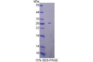 SDS-PAGE analysis of Mouse MRPL1 Protein. (MRPL1 蛋白)