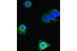 Immunofluorescent analysis of Hela cells using ABIN7150566 at dilution of 1:100 and Alexa Fluor 488-congugated AffiniPure Goat Anti-Rabbit IgG(H+L) (DOK2 抗体  (AA 123-412))