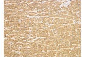 Immunohistochemistry (Paraffin-embedded Sections) (IHC (p)) image for anti-Toll-Interleukin 1 Receptor (TIR) Domain Containing Adaptor Protein (TIRAP) (C-Term) antibody (ABIN500927)