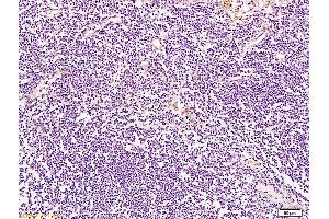 Formalin-fixed and paraffin embedded human lymph node tissue labeled with Anti-BRMS-1 Polyclonal Antibody, Unconjugated at 1:200 followed by conjugation to the secondary antibody and DAB staining (BRMS1L 抗体  (AA 151-246))