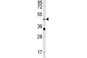 Western Blotting (WB) image for anti-Wingless-Type MMTV Integration Site Family, Member 5A (WNT5A) (AA 185-213) antibody (ABIN3029634)