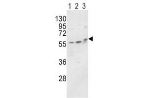 Western blot analysis of ALP / Alkaline Phosphatase antibody and MCF-7 (lane 1), HL-60 cell line (2) and mouse brain tissue (3) lysate. (ALPL 抗体  (AA 3-32))