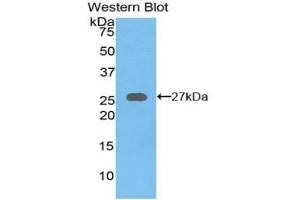 Detection of Recombinant AXIN, Mouse using Polyclonal Antibody to Axis Inhibition Protein (AXIN) (Axin 抗体  (AA 654-863))