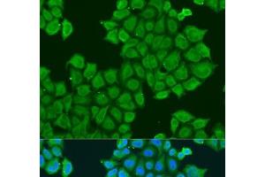 Immunofluorescence analysis of U2OS cells using STX12 Polyclonal Antibody at dilution of 1:100. (Syntaxin 12 抗体)