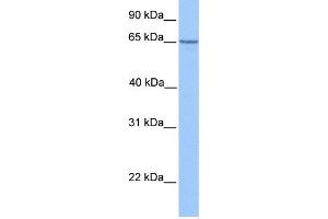 WB Suggested Anti-PML Antibody Titration:  1 ug/ml  Positive Control:  Hela cell lysate (PML 抗体  (C-Term))