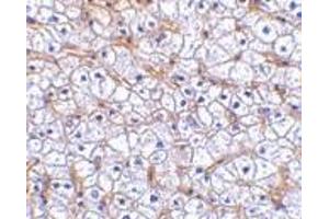 Immunohistochemistry of Fn14 in human liver tissue with Fn14 antibody at 2. (TNFRSF12A 抗体)