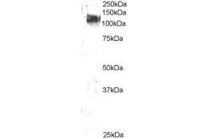 ABIN2561614 staining (2µg/ml) of 3T3 lysate (RIPA buffer, 35µg total protein per lane). (CBL 抗体  (C-Term))
