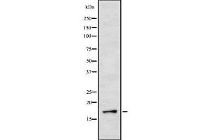 Western blot analysis IL3 using Jurkat whole cell lysates (IL-3 抗体  (Internal Region))