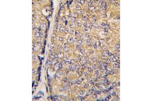 Immunohistochemistry (IHC) image for anti-Signal Transducing Adaptor Family Member 1 (STAP1) (AA 41-70), (N-Term) antibody (ABIN5535538)