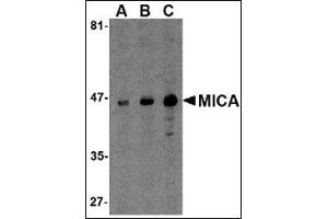 Western blot analysis of MICA in A-20 cell lysate with this product at (A) 0. (MICA 抗体  (C-Term))