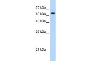 WB Suggested Anti-RAD17 Antibody Titration: 1. (RAD17 抗体  (C-Term))