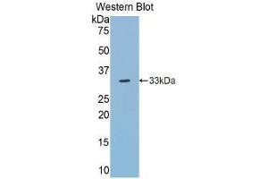 Western Blotting (WB) image for anti-Toll-Like Receptor 5 (TLR5) (AA 303-514) antibody (ABIN1860772) (TLR5 抗体  (AA 303-514))