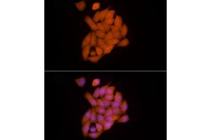 Immunofluorescence analysis of HeLa cells using Ube2L3 / UBCH7 Rabbit mAb (ABIN7271178) at dilution of 1:25 (40x lens). (UBE2L3 抗体)