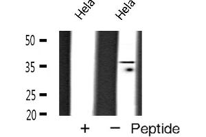 Western blot analysis of TBP expression in Hela cells (TBP 抗体  (N-Term))