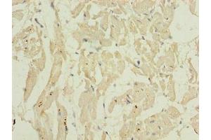 Immunohistochemistry of paraffin-embedded human heart tissue using ABIN7155653 at dilution of 1:100 (BARX1 抗体  (AA 1-100))