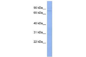 WB Suggested Anti-PAPOLB  Antibody Titration: 0. (PAPOLB 抗体  (N-Term))