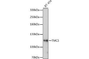Western blot analysis of extracts of BT-474 cells, using TMC5 antibody (ABIN7270941) at 1:1000 dilution.