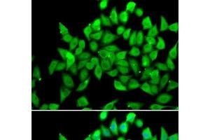 Immunofluorescence analysis of A549 cells using ALS2 Polyclonal Antibody (ALS2 抗体)
