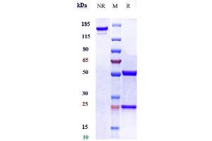 Anti-NAMPT Reference Antibody (Alt-100) on SDS-PAGE under reducing (R) condition.