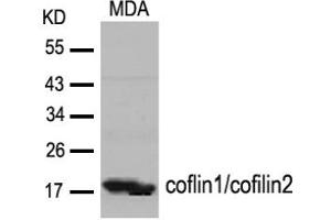 Image no. 2 for anti-Cofilin 1 (CFL1) (Tyr88) antibody (ABIN319381) (Cofilin 抗体  (Tyr88))