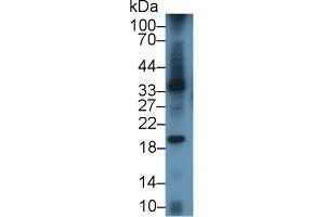 Detection of LAB7-1 in Mouse Spleen lysate using Polyclonal Antibody to B-Lymphocyte Activation Antigen B7-1 (LAB7-1) (CD80 抗体  (AA 38-246))