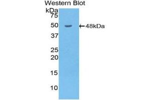 Western blot analysis of the recombinant protein. (HYAL1 抗体  (AA 52-462))