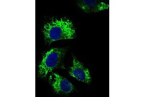 Immunocytochemistry (ICC) image for anti-Interleukin 2 Receptor, alpha (IL2RA) (AA 34-139) antibody (ABIN1845343)