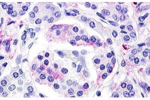 Image no. 1 for anti-G Protein-Coupled Receptor 119 (GPR119) (Cytoplasmic Domain) antibody (ABIN1048700) (G Protein-Coupled Receptor 119 抗体  (Cytoplasmic Domain))