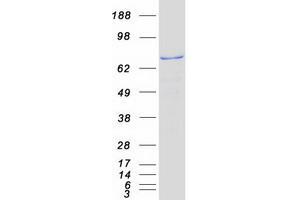Western Blotting (WB) image for Katanin P80 (WD Repeat Containing) Subunit B 1 (KATNB1) protein (Myc-DYKDDDDK Tag) (ABIN2723995)