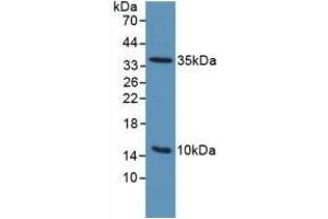 Detection of uPAR in Mouse Sp2/0 Cells using Polyclonal Antibody to Plasminogen Activator, Urokinase Receptor (uPAR) (PLAUR 抗体  (AA 13-114))