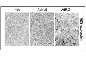 Image no. 2 for anti-PR Domain Containing 2, with ZNF Domain (PRDM2) (AA 245-573) antibody (ABIN356710) (PRDM2 抗体  (AA 245-573))