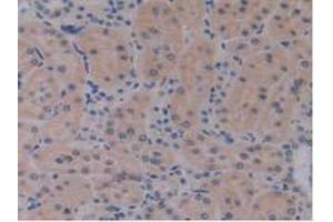 IHC-P analysis of Rat Kidney Tissue, with DAB staining. (IL17RE 抗体  (AA 457-626))