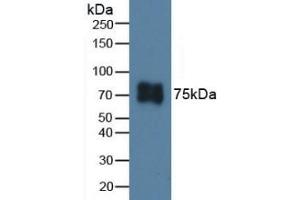 Detection of ITGb6 in Porcine Skin Tissue using Polyclonal Antibody to Integrin Beta 6 (ITGb6) (ITGB6 抗体  (AA 131-371))