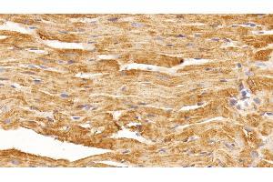 Detection of VEGFA in Rat Cardiac Muscle Tissue using Monoclonal Antibody to Vascular Endothelial Growth Factor A (VEGFA) (VEGFA 抗体  (AA 27-214))