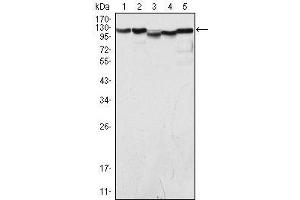 Western Blot showing LSD1 antibody used against COS (1), Hela (2), NIH/3T3 (3), A549 (4) and Jurkat (5) cell lysate. (LSD1 抗体)