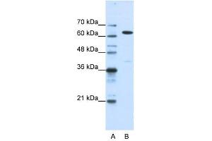 NXF1 antibody used at 1. (NXF1 抗体  (N-Term))