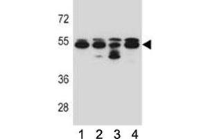 TUBB8 antibody western blot analysis in 293, A549, HepG2, K562 lysate. (Tubulin, beta 8 抗体  (AA 34-62))