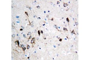 IHC-P: NMDAR1 antibody testing of rat brain tissue (GRIN1/NMDAR1 抗体  (N-Term))