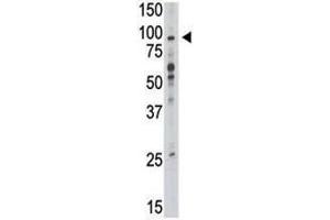 Western blot analysis of TLR6 antibody and mouse liver tissue lysate (TLR6 抗体  (AA 393-423))