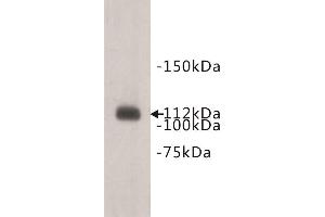 Western Blotting (WB) image for anti-Transmembrane Protein 67 (TMEM67) antibody (ABIN1854943) (TMEM67 抗体)