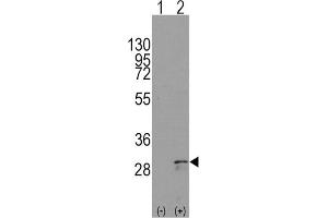 Western Blotting (WB) image for anti-KIT Ligand (KITLG) antibody (ABIN2998288) (KIT Ligand 抗体)